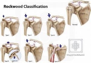 sd_rockwood_classification
