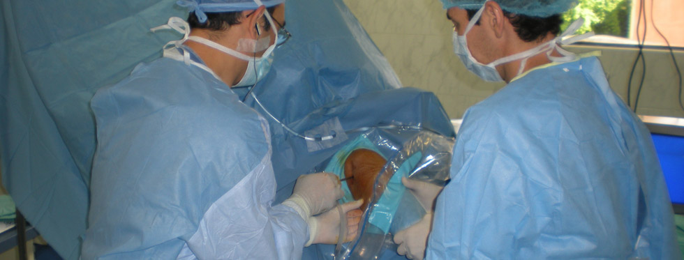 Artroscopía de hombro